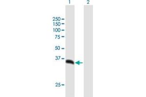 Western Blotting (WB) image for anti-Proteasome (Prosome, Macropain) 26S Subunit, Non-ATPase, 14 (PSMD14) (AA 1-310) antibody (ABIN948909)