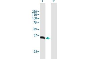 Western Blot analysis of PSMD14 expression in transfected 293T cell line by PSMD14 MaxPab polyclonal antibody. (PSMD14 抗体  (AA 1-310))