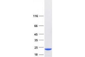 Western Blotting (WB) image for Chromosome 14 Open Reading Frame 126 (C14orf126) protein (Myc-DYKDDDDK Tag) (ABIN2715405)