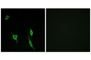 Immunofluorescence (IF) image for anti-Deleted in Colorectal Carcinoma (DCC) (Internal Region) antibody (ABIN1850423) (DCC 抗体  (Internal Region))
