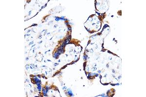 Immunohistochemistry of paraffin-embedded Human placenta using p38 MAPK Rabbit pAb (ABIN7268616) at dilution of 1:100 (40x lens). (MAPK14 抗体  (C-Term))