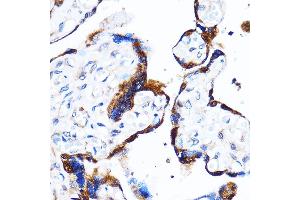 Immunohistochemistry of paraffin-embedded Human placenta using p38 MAPK Rabbit pAb (ABIN7268616) at dilution of 1:100 (40x lens).