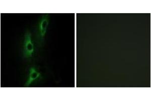 Immunofluorescence analysis of NIH-3T3 cells, using ADRB2 Antibody.