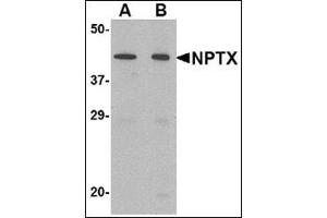 Western blot analysis of NPTX2 in mouse brain tissue lysate with this product at (A) 0. (NPTX2 抗体  (Center))