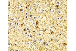 Immunohistochemistry of paraffin-embedded Rat brain using BIN1 Polyclonal Antibody at dilution of 1:100 (40x lens). (BIN1 抗体)