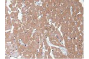 IHC-P analysis of Rat Heart Tissue, with DAB staining. (CAMK2A 抗体  (AA 1-478))
