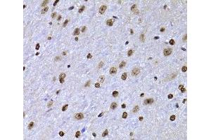 Immunohistochemistry (Paraffin-embedded Sections) (IHC (p)) image for anti-SRY (Sex Determining Region Y)-Box 5 (SOX5) antibody (ABIN7262915)