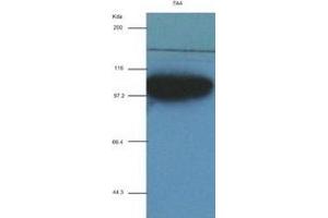 ACTN1 antibody (7A4) at 1:2000 + recombinant human ACTN1 (ACTN1 抗体  (AA 650-893))