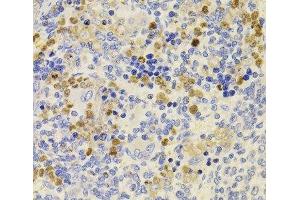 Immunohistochemistry of paraffin-embedded Rat spleen using PRDM5 Polyclonal Antibody at dilution of 1:100 (40x lens). (PRDM5 抗体)