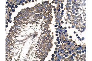 ABIN6261894 and ABIN6268716 at 1/100 staining Rat testis tissue by IHC-P. (GATA5 抗体  (Internal Region))