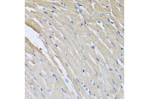 Immunohistochemistry of paraffin-embedded rat heart using CRHBP antibody (ABIN6129571, ABIN6139030, ABIN6139033 and ABIN6222243) at dilution of 1:100 (40x lens). (CRHBP 抗体  (AA 25-322))
