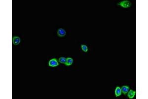 Immunofluorescent analysis of HepG2 cells using ABIN7167280 at dilution of 1:100 and Alexa Fluor 488-congugated AffiniPure Goat Anti-Rabbit IgG(H+L) (RAB28 抗体  (AA 98-218))