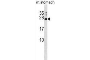 Western Blotting (WB) image for anti-RAP2C, Member of RAS Oncogene Family (RAP2C) antibody (ABIN3001185) (RAP2C 抗体)