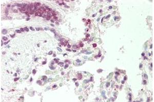 Immunohistochemistry (IHC) image for anti-DnaJ (Hsp40) Homolog, Subfamily B, Member 1 (DNAJB1) (AA 74-123) antibody (ABIN6754951)