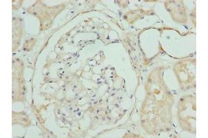 Immunohistochemistry of paraffin-embedded human kidney tissue using ABIN7147805 at dilution of 1:100 (CLYBL 抗体  (AA 23-340))