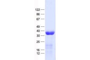 Western Blotting (WB) image for Selenophosphate Synthetase 1 (SEPHS1) protein (His tag) (ABIN2731659)