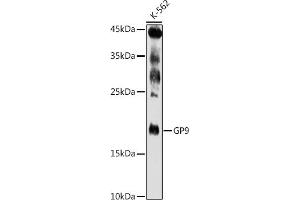 Western blot analysis of extracts of K-562 cells, using GP9 antibody (ABIN6127598, ABIN6141293, ABIN6141294 and ABIN6221019) at 1:500 dilution. (CD42a 抗体  (AA 17-147))