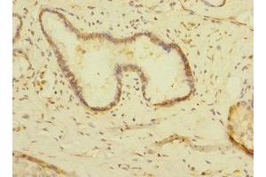 Immunohistochemistry of paraffin-embedded human pancreatic tissue using ABIN7158909 at dilution of 1:100 (MPP6 抗体  (AA 220-420))