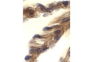 Immunohistochemistry of TRIF in human lung tissue with this product at 10 μg/ml. (TICAM1 抗体  (C-Term))