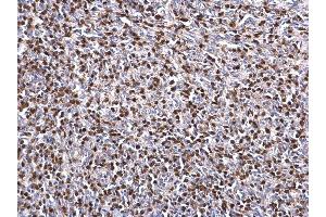 IHC-P Image ZAP70 antibody detects ZAP70 protein at nucleus on mouse lymph node by immunohistochemical analysis. (ZAP70 抗体  (Center))