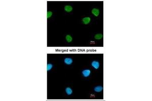 ICC/IF Image Immunofluorescence analysis of paraformaldehyde-fixed HeLa, using PARP1, antibody at 1:200 dilution. (PARP1 抗体)