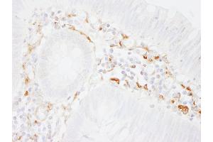 Immunohistochemistry (IHC) image for anti-Filamin A, alpha (FLNA) (AA 1725-1775) antibody (ABIN7454720)