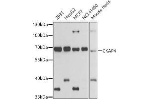 Western blot analysis of extracts of various cell lines, using CK antibody (ABIN6134474, ABIN6138645, ABIN6138646 and ABIN6223731) at 1:500 dilution. (CKAP4 抗体)