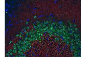 Indirect immunostaining of PFA fixed paraffin embedded mouse hippocampus section with anti-bassoon (dilution 1 : 500; red) and Guinea pig anti-NeuN (, dilution 1 : 500; green). (Bassoon 抗体  (Center))