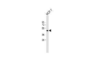 Anti-ETS2 Antibody (Center) at 1:2000 dilution + MCF-7 whole cell lysate Lysates/proteins at 20 μg per lane. (ETS2 抗体  (AA 146-173))