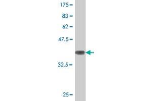 Western Blot detection against Immunogen (36. (ATG5 抗体  (AA 176-275))