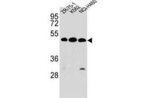 Western Blotting (WB) image for anti-Kringle Containing Transmembrane Protein 2 (KREMEN2) antibody (ABIN2997109) (KREMEN2 抗体)