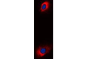 Immunofluorescence (IF) image for anti-Solute Carrier Family 25 (Mitochondrial Carrier, Adenine Nucleotide Translocator), Member 31 (SLC25A31) (Center) antibody (ABIN7298420)