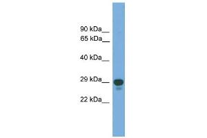 WB Suggested Anti-PRRX2 Antibody Titration: 0. (PRRX2 抗体  (Middle Region))