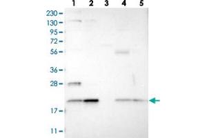 Western blot analysis of Lane 1: RT-4, Lane 2: U-251 MG, Lane 3: Human Plasma, Lane 4: Liver, Lane 5: Tonsil with TMEM65 polyclonal antibody  at 1:250-1:500 dilution. (TMEM65 抗体)