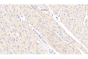 Immunohistochemistry (IHC) image for anti-NADH Dehydrogenase (Ubiquinone) Fe-S Protein 1, 75kDa (NADH-Coenzyme Q Reductase) (NDUFS1) (AA 524-727) antibody (ABIN7441598)