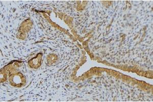ABIN6276635 at 1/100 staining Human uterus tissue by IHC-P. (Syndecan 1 抗体  (C-Term))