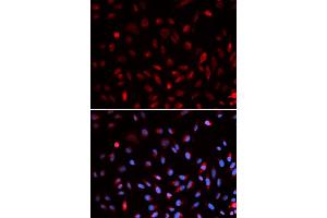 Immunofluorescence analysis of U2OS cells using ERCC1 antibody (ABIN5973037).