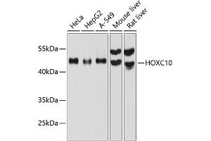 Western blot analysis of extracts of various cell lines, using HOXC10 antibody (ABIN6129025, ABIN6141948, ABIN6141949 and ABIN6215814) at 1:1000 dilution. (HOXC10 抗体  (AA 1-260))
