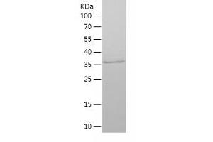 Western Blotting (WB) image for Antigen Identified By Monoclonal Antibody Ki-67 (MKI67) (AA 762-1016) protein (His tag) (ABIN7121860) (Ki-67 Protein (AA 762-1016) (His tag))