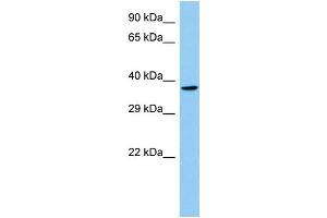 Host: Rabbit Target Name: Lhx8 Sample Type: Rat Thymus lysates Antibody Dilution: 1. (LHX8 抗体  (N-Term))