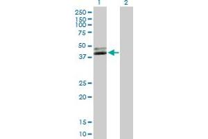 Western Blot analysis of NUDT9 expression in transfected 293T cell line by NUDT9 MaxPab polyclonal antibody. (NUDT9 抗体  (AA 1-350))
