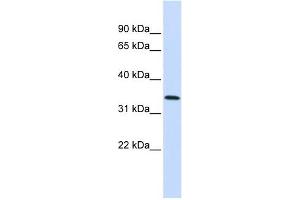 Annexin A4 antibody used at 1 ug/ml to detect target protein. (Annexin IV 抗体  (Middle Region))
