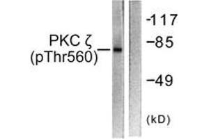 Western blot analysis of extracts from COS7 cells treated with PMA 125ng/ml 30', using PKC zeta (Phospho-Thr560) Antibody. (PKC zeta 抗体  (pThr560))