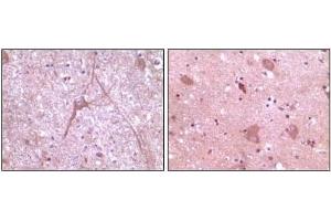 Immunohistochemical analysis of paraffin-embedded human cerebrum tissue (left) and myelencephalon tissue (right), showing cytoplasmic localization using Dynamin2 mouse mAb with DAB staining.