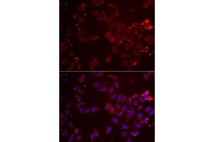 Immunofluorescence analysis of  cells using GATM antibody (ABIN6133283, ABIN6140984, ABIN6140985 and ABIN6222282). (GATM 抗体  (AA 124-423))