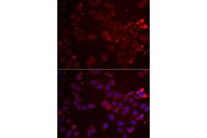 Immunofluorescence analysis of  cells using GATM antibody (ABIN6133283, ABIN6140984, ABIN6140985 and ABIN6222282). (GATM 抗体  (AA 124-423))