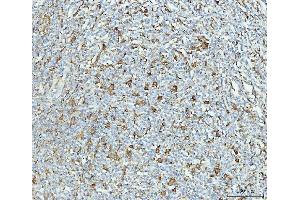 IHC analysis of Grp75 using anti-Grp75 antibody (ABIN7602782). (HSPA9 抗体  (C-Term))