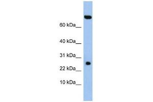 ZSWIM3 antibody used at 1 ug/ml to detect target protein. (ZSWIM3 抗体  (N-Term))