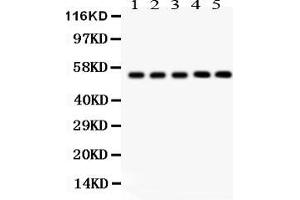 Western Blotting (WB) image for anti-Y Box Binding Protein 1 (YBX1) (AA 293-320), (C-Term) antibody (ABIN3043966)