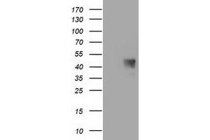 HEK293T cells were transfected with the pCMV6-ENTRY control (Left lane) or pCMV6-ENTRY C1orf161 (Right lane) cDNA for 48 hrs and lysed. (MAB21L3 抗体)